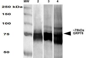 Western Blot analysis of Human, Mouse, Rat HEK-293, NIH3T3, and Rat Brain cell lysates showing detection of GRP78 protein using Mouse Anti-GRP78 Monoclonal Antibody, Clone 3G12-1G11 . (GRP78 anticorps  (HRP))