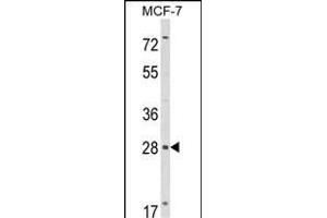 Western blot analysis of RASL11B Antibody (N-term) (ABIN652737 and ABIN2842488) in MCF-7 cell line lysates (35 μg/lane). (RASL11B anticorps  (N-Term))