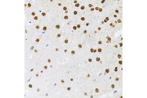 Immunohistochemistry of paraffin-embedded mouse brain using FAF1 antibody (ABIN5975642) (40x lens). (FAF1 anticorps)