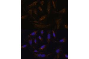 Immunofluorescence analysis of U-2 OS cells using UCP4 antibody (ABIN6132767, ABIN6147925, ABIN6147927 and ABIN6217968) at dilution of 1:100. (SLC25A27 anticorps  (AA 1-245))