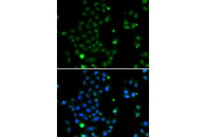 Immunofluorescence analysis of MCF-7 cells using GCM1 antibody (ABIN5974384). (GCM1 anticorps)
