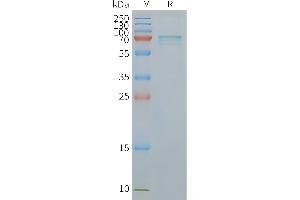 Human P2RX7-Nanodisc, Flag Tag on SDS-PAGE (P2RX7 Protéine)