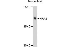 Western blot analysis of extracts of mouse brain, using HRAS Antibody (ABIN5997928) at 1:3000 dilution. (HRAS anticorps)