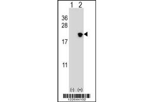 Western blot analysis of NIP7 using rabbit polyclonal NIP7 Antibody using 293 cell lysates (2 ug/lane) either nontransfected (Lane 1) or transiently transfected (Lane 2) with the NIP7 gene. (NIP7 anticorps  (C-Term))