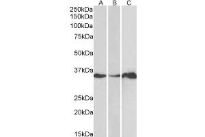 Western Blotting (WB) image for anti-LIM and SH3 Protein 1 (LASP1) antibody (ABIN5921969) (LASP1 anticorps)