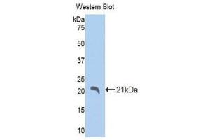 Western Blotting (WB) image for anti-Indian Hedgehog (IHH) (AA 240-399) antibody (ABIN1175999) (Indian Hedgehog anticorps  (AA 240-399))