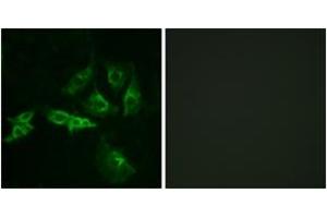 Immunofluorescence (IF) image for anti-Gonadotropin-Releasing Hormone Receptor (GNRHR) (AA 41-90) antibody (ABIN2890834) (GNRHR anticorps  (AA 41-90))