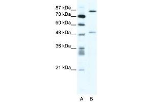 MMP10 antibody (20R-1313) used at 0. (MMP10 anticorps  (N-Term))