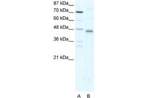 Western Blotting (WB) image for anti-Zfp-1 antibody (ABIN2460391) (Zfp-1 anticorps)