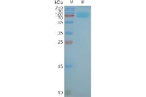 Human CD36-Nanodisc, Flag Tag on SDS-PAGE (CD36 Protein (CD36))