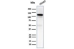 Western blot analysis of Heart tissue lysate using N-Cadherin Mouse Monoclonal Antibody (13A9). (N-Cadherin anticorps  (Cytoplasmic Domain))