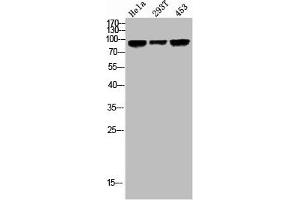 Western Blot analysis of HELA 293T 453 cells using Phospho-GR (S203) Polyclonal Antibody (Glucocorticoid Receptor anticorps  (pSer203))
