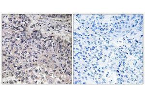 Immunohistochemistry (IHC) image for anti-Complement Component 1, Q Subcomponent, C Chain (C1QC) (Internal Region) antibody (ABIN1851148) (C1QC anticorps  (Internal Region))