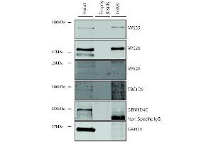 Immunoprecipitation analysis using Mouse Anti-VPS35 Monoclonal Antibody, Clone 10A8 (ABIN6933001). (VPS35 anticorps  (PerCP))