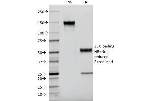 SDS-PAGE Analysis Purified EGFR Mouse Monoclonal Antibody (F4). (EGFR anticorps  (AA 985-996))