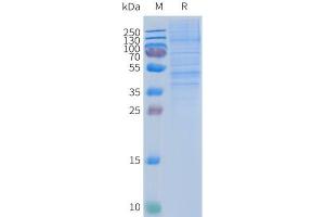 Human -Nanodisc, Flag Tag on SDS-PAGE (CCR2 Protéine)