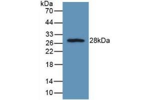 Western blot analysis of recombinant Rat FGFRL1. (FGFRL1 anticorps  (AA 164-368))