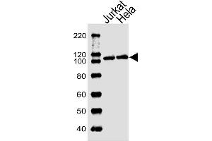 Lane 1: Jurkat Cell lysates, Lane 2: HeLa Cell lysates, probed with USP11 (1220CT620. (USP11 anticorps)