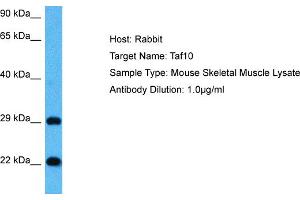 Host: Mouse Target Name: TAF10 Sample Tissue: Mouse Skeletal Muscle Antibody Dilution: 1ug/ml (TAF10 anticorps  (Middle Region))