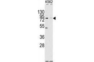 Western Blotting (WB) image for anti-Lysine (K)-Specific Demethylase 2A (KDM2A) antibody (ABIN2995648) (KDM2A anticorps)