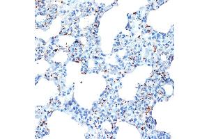 Immunohistochemistry of paraffin-embedded rat lung using CXCL4/CXCL4/PF4 Rabbit mAb (ABIN1683188, ABIN3017983, ABIN3017984 and ABIN7101555) at dilution of 1:100 (40x lens). (PF4 anticorps)
