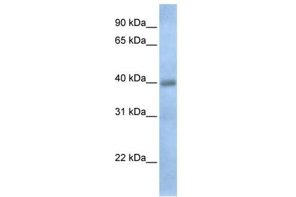 TXNDC15 anticorps  (C-Term)