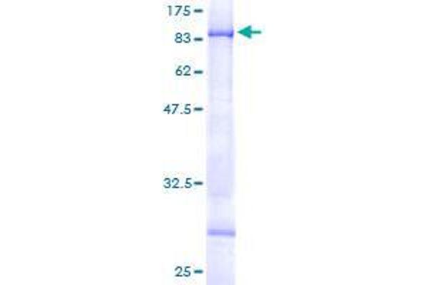 CHST15 Protein (AA 1-561) (GST tag)