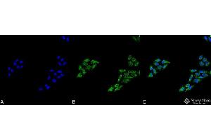 Immunocytochemistry/Immunofluorescence analysis using Rabbit Anti-p53 Polyclonal Antibody . (p53 anticorps  (C-Term) (HRP))