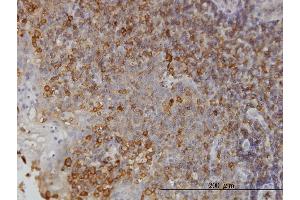 Immunoperoxidase of monoclonal antibody to NMI on formalin-fixed paraffin-embedded human tonsil. (NMI anticorps  (AA 1-100))