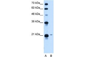 WB Suggested Anti-TCP10L Antibody Titration:  1. (TCP10L anticorps  (Middle Region))