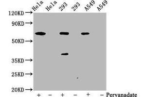 Western Blot Positive WB detected in Hela whole cell lysate ? (Recombinant PTPN11 anticorps  (pTyr542))