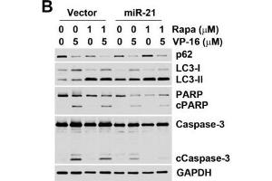 Western Blotting (WB) image for anti-Sequestosome 1 (SQSTM1) antibody (ABIN2854836)