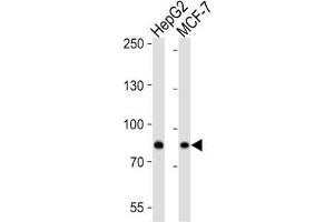 Western Blotting (WB) image for anti-Ubiquitin Specific Peptidase 51 (USP51) antibody (ABIN3004645) (USP51 anticorps)