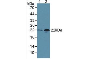 Western Blot; Sample: Lane1: Human Serum; Lane2: Rat Heart Tissue. (NT-ProBNP anticorps)