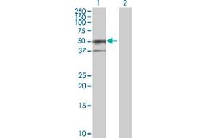 Western Blot analysis of SERPINA6 expression in transfected 293T cell line by SERPINA6 MaxPab polyclonal antibody. (SERPINA6 anticorps  (AA 1-405))