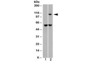 Western blot of HEK293 lysate overexpressing IDE probed with IDE antibody (mock transfection in lane 1). (IDE anticorps)