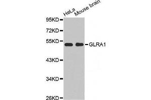 Western Blotting (WB) image for anti-Glycine Receptor, alpha 1 (GLRA1) (AA 29-247) antibody (ABIN6219938) (GLRA1 anticorps  (AA 29-247))