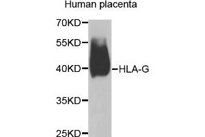 Western blot analysis of extracts of human placenta, using HLA-G antibody (ABIN5974455) at 1/1000 dilution. (HLAG anticorps)