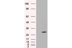 Western Blotting (WB) image for anti-Chromosome 21 Open Reading Frame 59 (C21orf59) antibody (ABIN1497044) (C21orf59 anticorps)