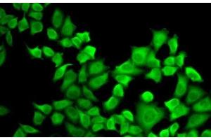 Immunofluorescence analysis of A-549 cells using DHFR Polyclonal Antibody (Dihydrofolate Reductase anticorps)