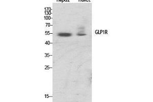 Western Blot (WB) analysis of specific cells using GLP-1R Polyclonal Antibody. (GLP1R anticorps  (Internal Region))