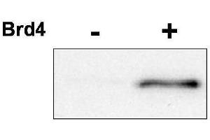 Western blot using  affinity purified anti-CDK9 pT29 antibody shows detection of phosphorylated CDK9. (CDK9 anticorps  (pThr29))