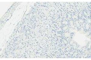 Immunohistochemistry (IHC) image for anti-TLR4 /MD2 Complex antibody (ABIN2665420) (TLR4 /MD2 Complex anticorps)