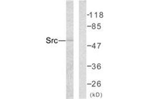 Western Blotting (WB) image for anti-Proto-oncogene tyrosine-protein kinase Src (Src) (AA 386-435) antibody (ABIN2889066) (Src anticorps  (AA 386-435))