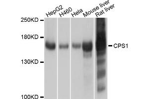 Western blot analysis of extracts of various cell lines, using CPS1 antibody. (CPS1 anticorps)