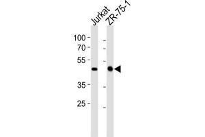 Western Blotting (WB) image for anti-ECSIT (ECSIT) antibody (ABIN2998295) (ECSIT anticorps)