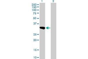 Western Blot analysis of SULT1C2 expression in transfected 293T cell line by SULT1C2 MaxPab polyclonal antibody. (SULT1C2 anticorps  (AA 1-296))