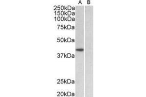 AP31930PU-N TBP antibody staining of HeLa nuclear (A) and cytosolic (B) lysates at 1 µg/ml (35µg protein in RIPA buffer). (TBP anticorps  (Internal Region))