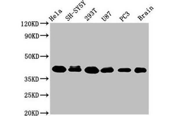 KTI12 anticorps  (AA 110-204)