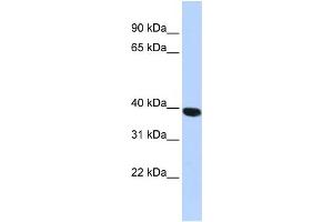 Western Blotting (WB) image for anti-Hyaluronidase-1 (HYAL1) (N-Term) antibody (ABIN2784342)